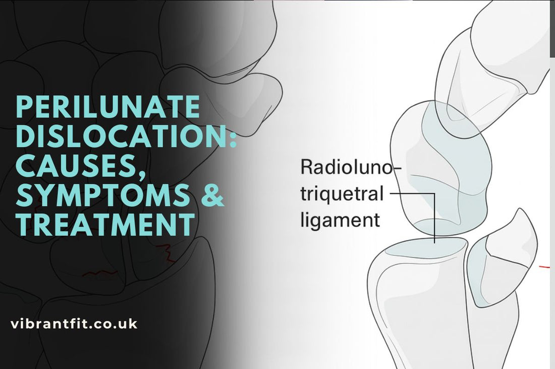 What is Perilunate Dislocation