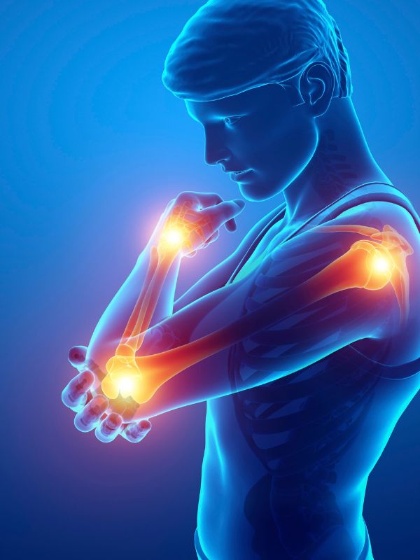 Arm Splints