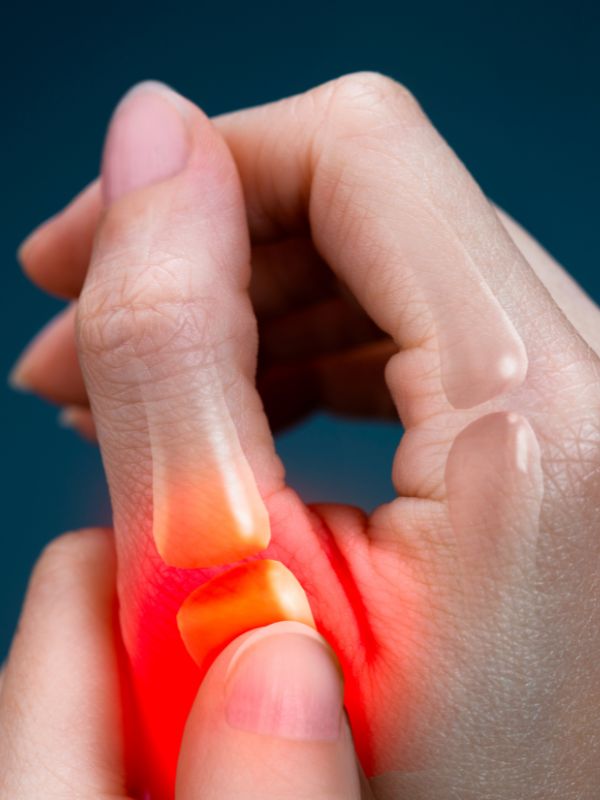 Thumb Spica Splints