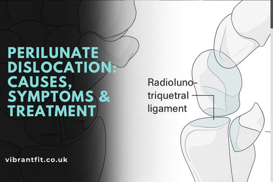 What is Perilunate Dislocation