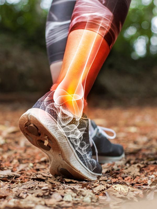 Ankle Support for Walking